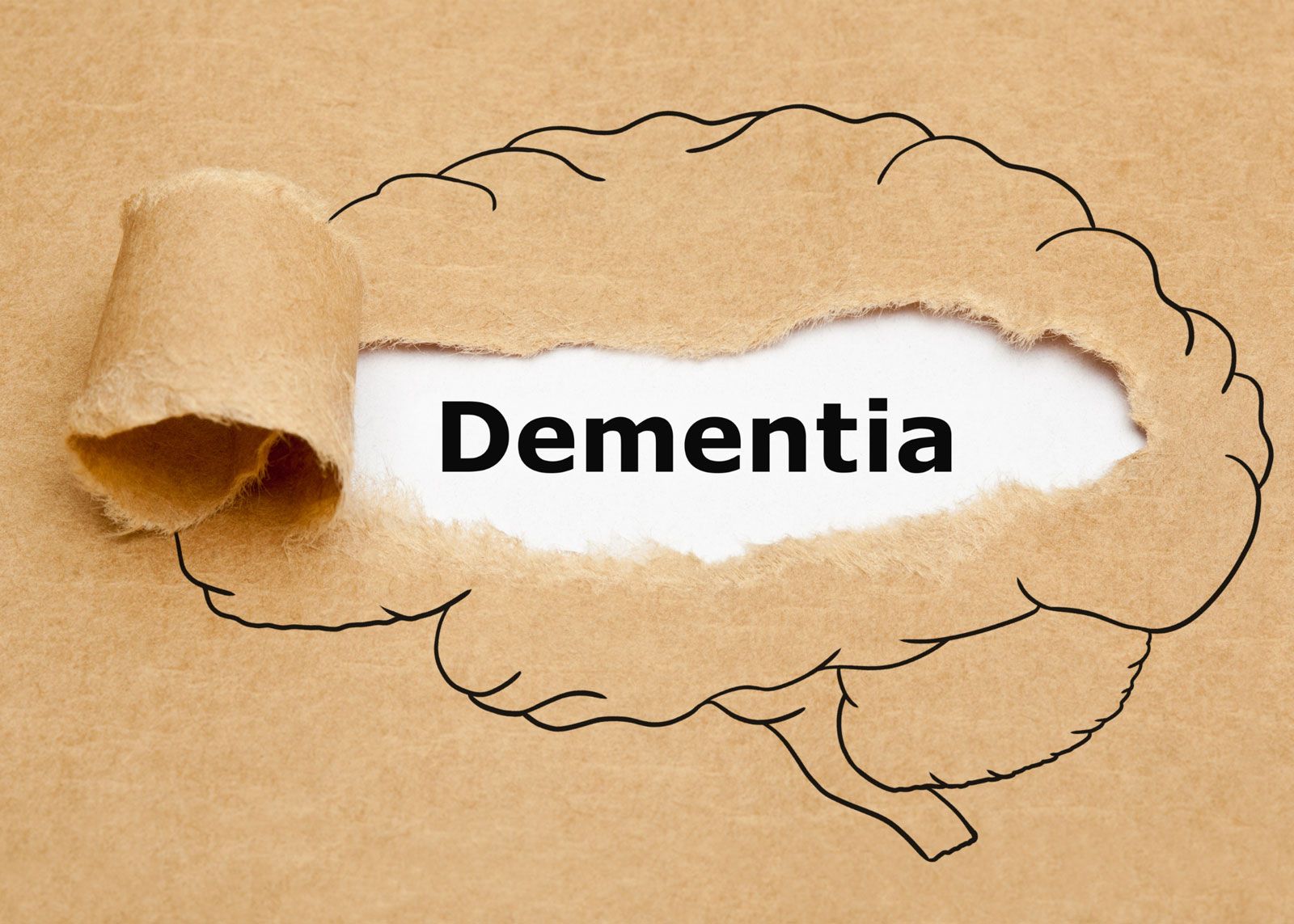 Dos and Don'ts to Defer Dementia